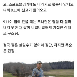 살기 위해 스스로 팔을 잘라낸 사람들. jpg