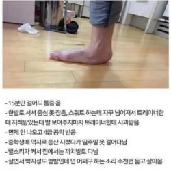 평발 레전드