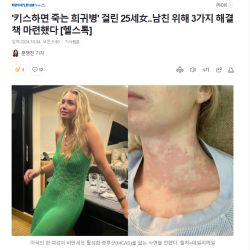 키스하면 죽는 희귀병' 걸린 25세女..남친 위해 3가지 해결책