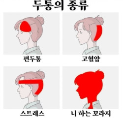 두통의 종류