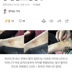 버스서 팔 닿았다고...3살 아이 쌍코피에 할머니까지 폭행한 20대 여성