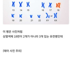 현재 미국에서 모르는 사람이 없는 수준인 임신부 [사진주의]