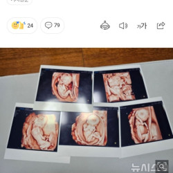 다섯쌍둥이 출산한 부부 1억7000만원 받는다