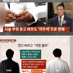 성기확대 수술 받았다가 절단..jpg