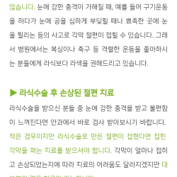 [수술장면 주의] 실제 라식 수술 과정