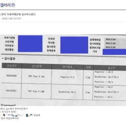 대구 헤르페스역병 근황