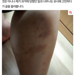 가수 제시 일행 17년도 폭행피해자입니다.pann