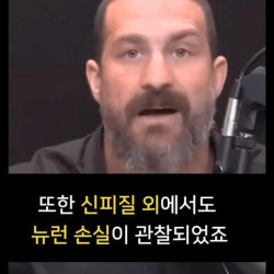 술 1잔이 뇌에 끼치는 영향 ㄷㄷ